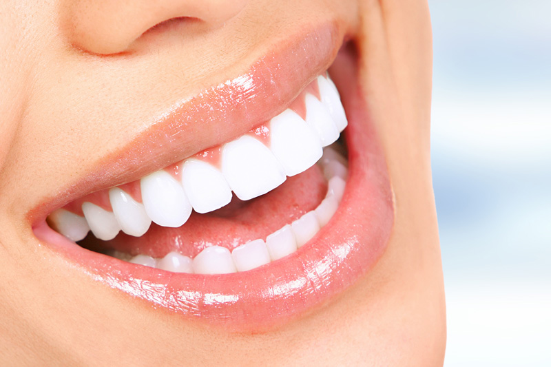 Cosmetic Dentistry in Los Angeles