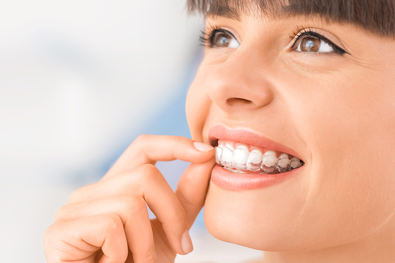 Orthodontics in Los Angeles